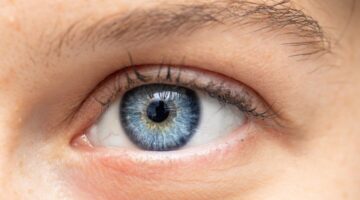 Beyond Progression: How Stem Cell Therapy in India Offers a New Horizon for Retinitis Pigmentosa Patients